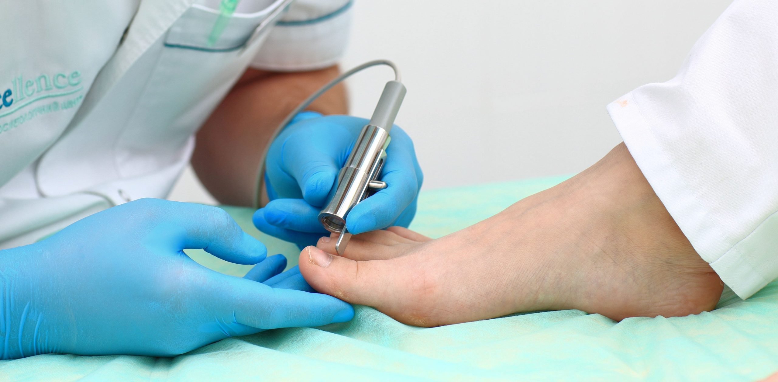 Лікування грибка нігтів (оніхомікоз) лазером