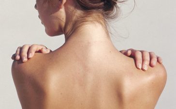 Чистка спини: здорова гладка шкіра без недоліків