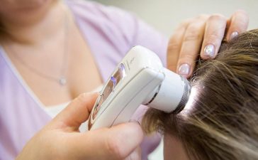 Трихоскопія — ключовий метод діагностики стану волосся та шкіри голови