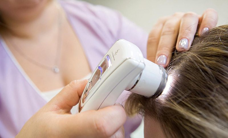 Трихоскопія — ключовий метод діагностики стану волосся та шкіри голови