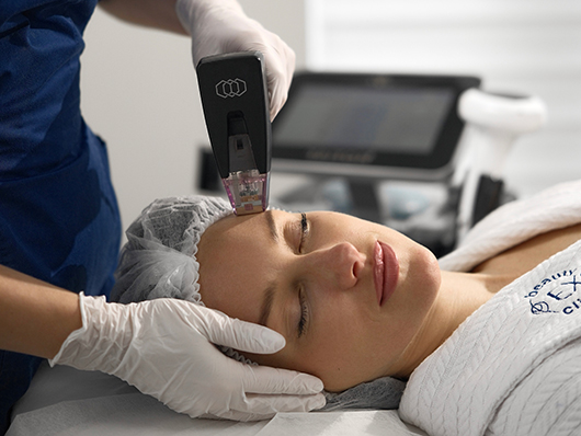 Мікроголковий RF ліфтинг Morpheus 8