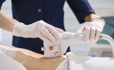 SMAS-ліфтинг у Києві: чи дійсно це альтернатива операції?