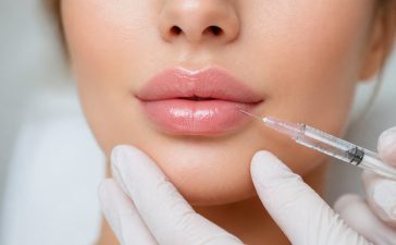 Акція на губи &mdash; Volift Retouch 5000 грн (замість 5800)