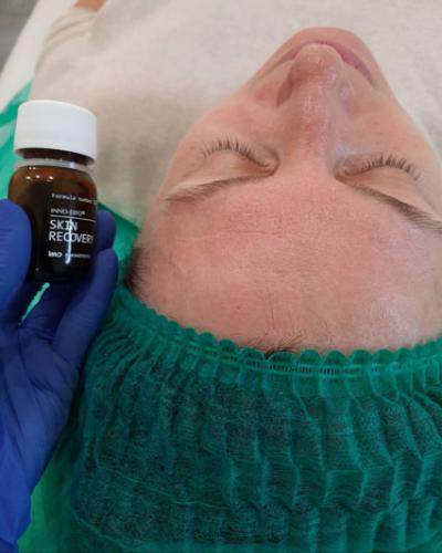 Пилинг-для-лица-Skin-Recovery-Доценко-Лилия-Григорьевна2